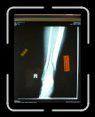 0306-LocasLeg13 * 1920 x 2560 * (1.92MB)
