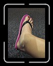 0808-HuracanPuta208 * My dearly swolen cankle! * 2304 x 3072 * (3.46MB)