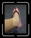 0808-HuracanPuta209 * The other swollen cankle. * 2304 x 3072 * (3.48MB)